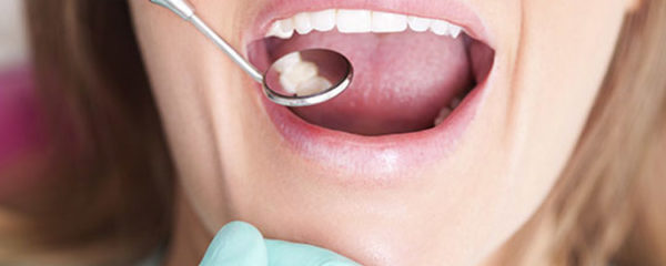 infections dentaires